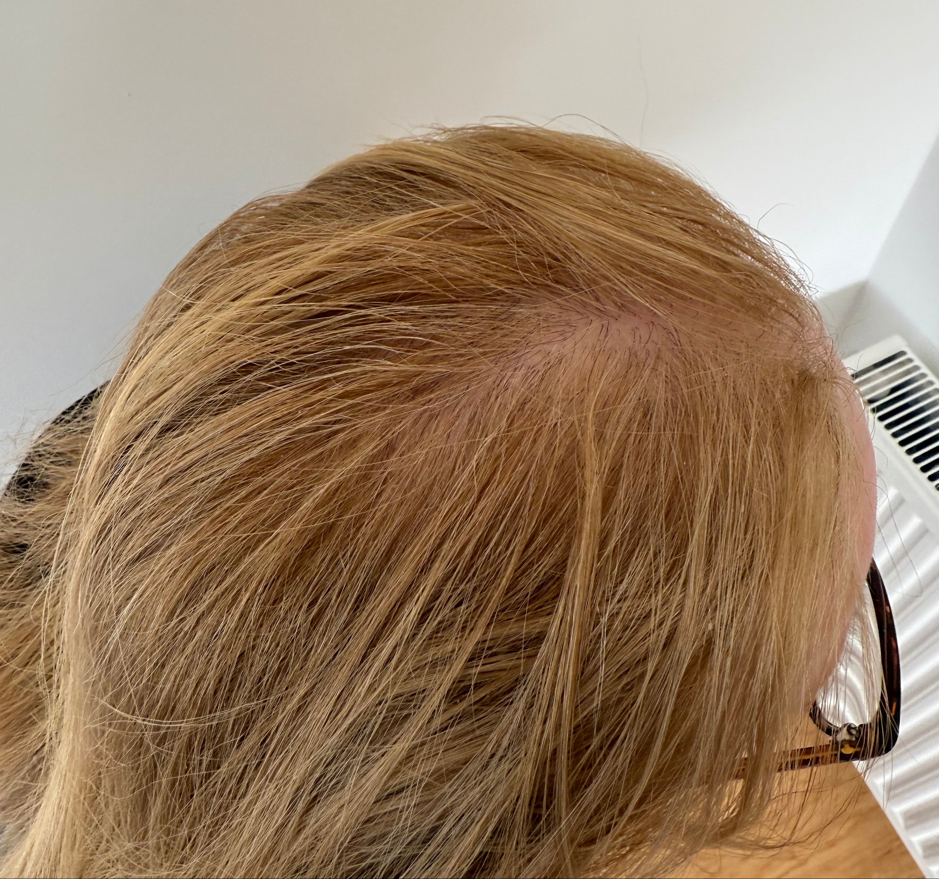 hormonal-hair-changes-best-hair-oil-for-blonde-hair